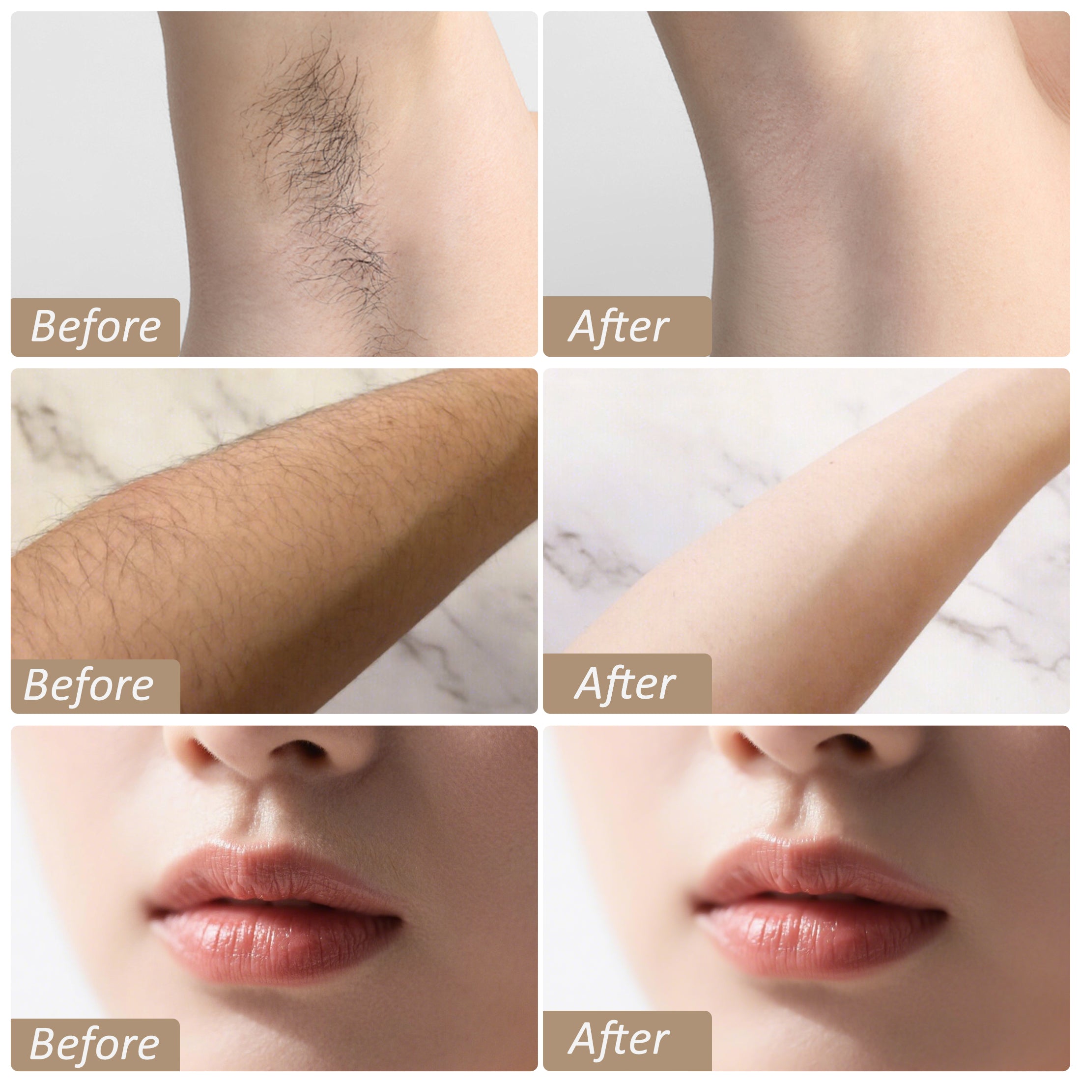CATLK IPL Hair Removal – 999,000 Flashes Laser Device for Face & Body